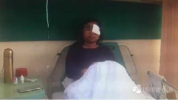 400元新買手機胸前爆炸起火 生產(chǎn)廠家是深圳公司