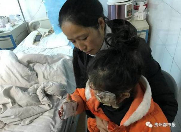 三星Note手機(jī)又爆炸 把女童炸成二級(jí)燒傷