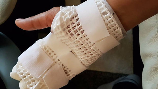 HTC旗艦手機爆炸傷人嚴(yán)重 官方沉默